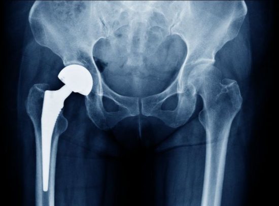 438D8Ab0 Bbfe E10B Bf3A 89Bc0B3B48C4