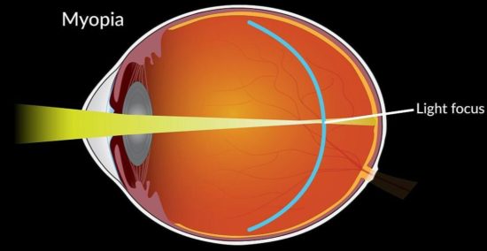 Cd65979D 498C 7E0B 658C 5E1664E09917 1